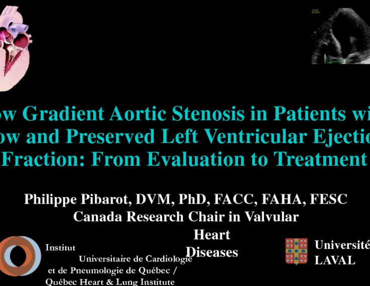 Low Gradient Aortic Stenosis in Patients with Low and Preserved