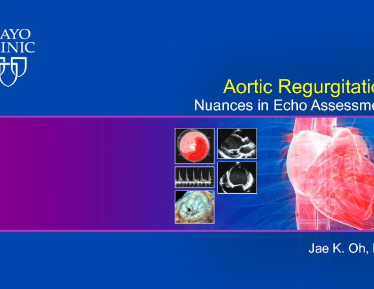 aortic regurgitation echo