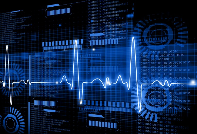 Asymptomatic left ventricular dysfunction : Study uses AI to create early  detector of heart disease 
