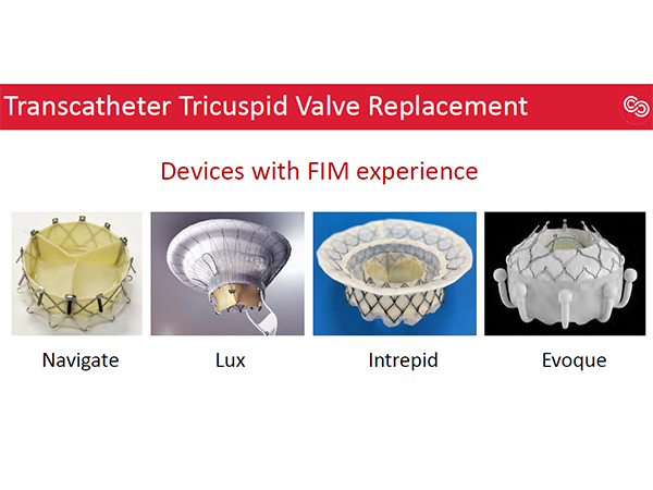 tricuspid valve replacement