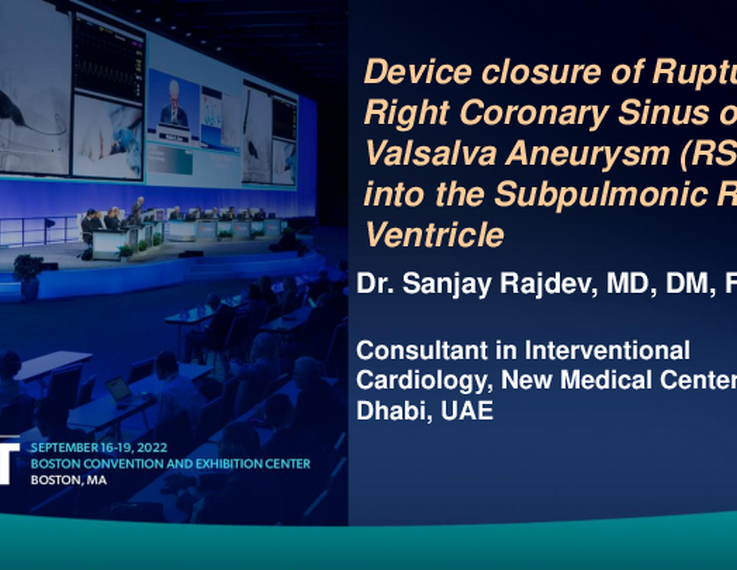 Acute Left Ventricular Systolic Dysfunction Following Device Closure of  Ruptured Sinus of Valsalva Aneurysm