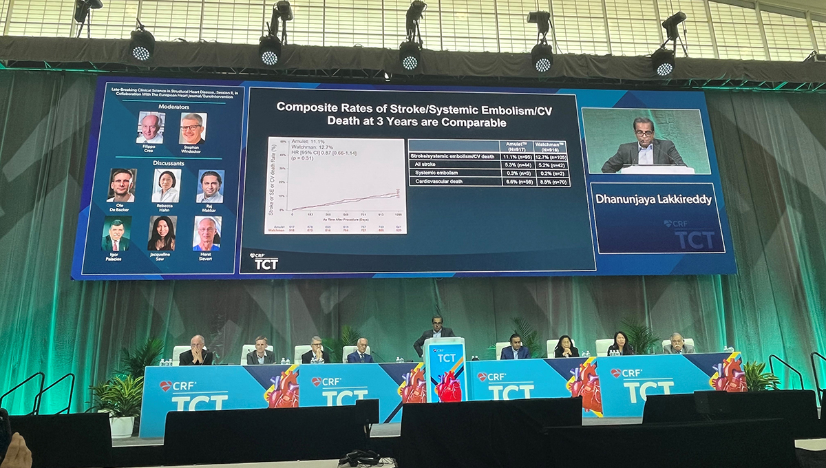 First Comparison of Amulet and Watchman FLX LAA Closure Devices Found  Similar Outcomes