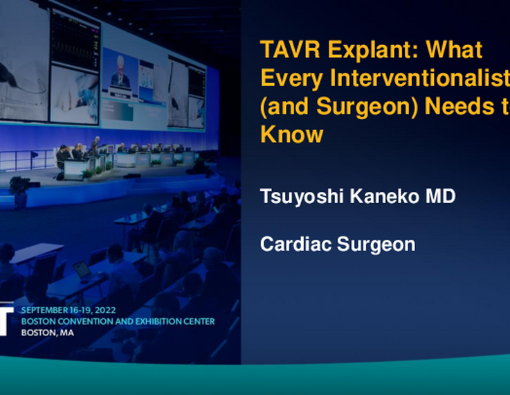 TAVR Explant: What Every Interventionalist (and Surgeon