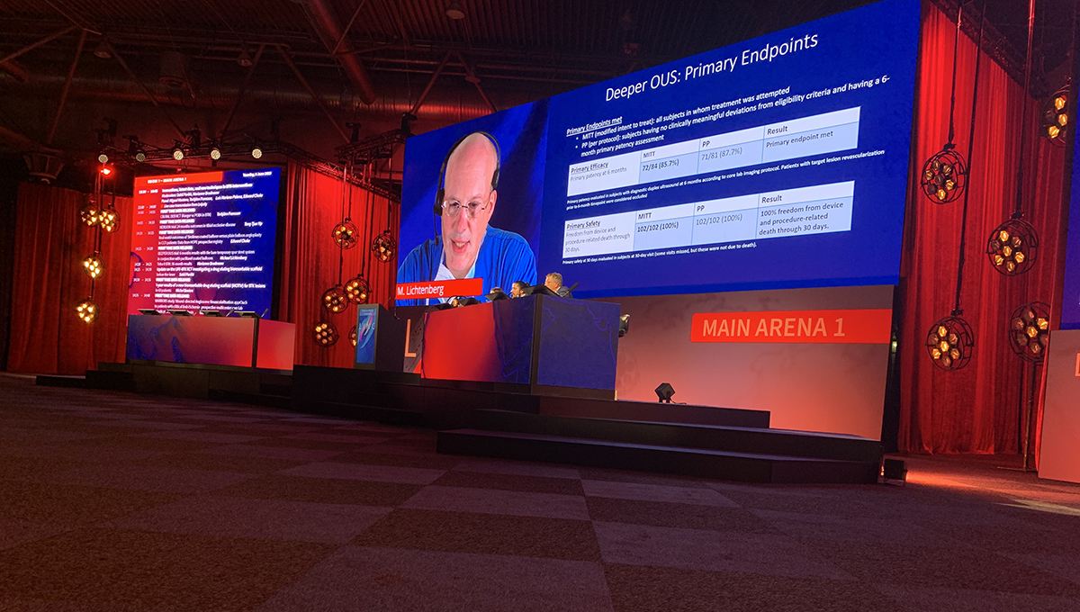 Early Data on Temporary Spur in BTK PAD Show Efficacy, Limited Recoil - Vimarsana News