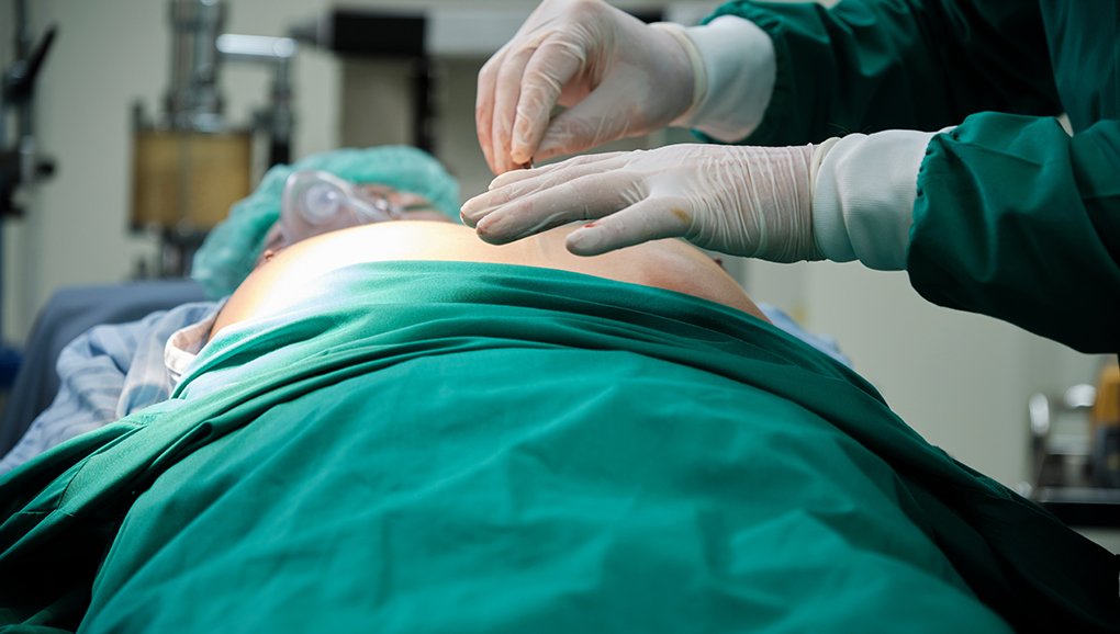 Earlier Extraction for Cardiac Device Infections Tied to Lower ...