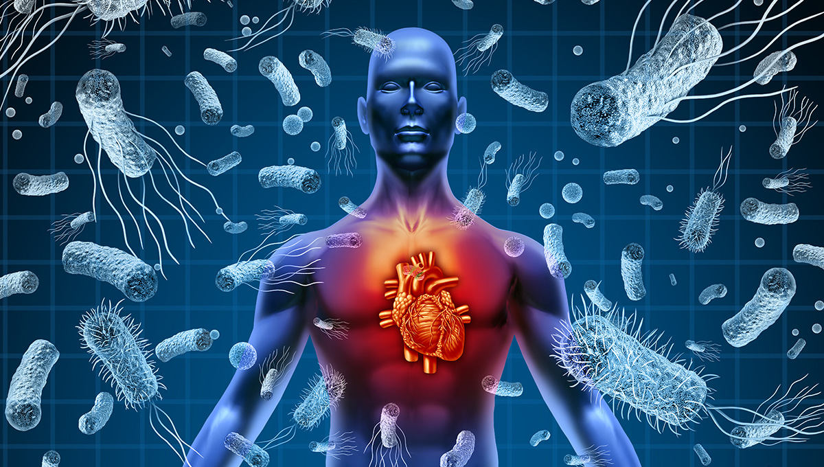 New Advice Released on Advanced Imaging for Evaluation of CV Infections ...