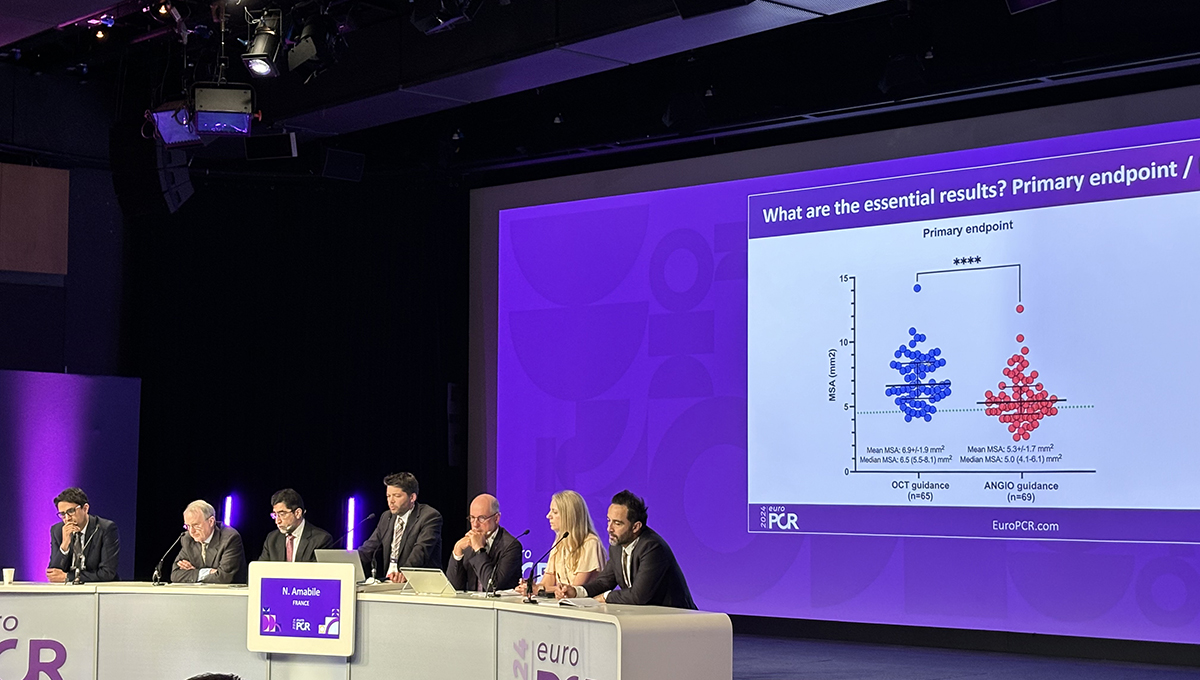 OCT-Based Strategy Outperforms Angiography in Calcified Lesions: CALIPSO - Vimarsana News