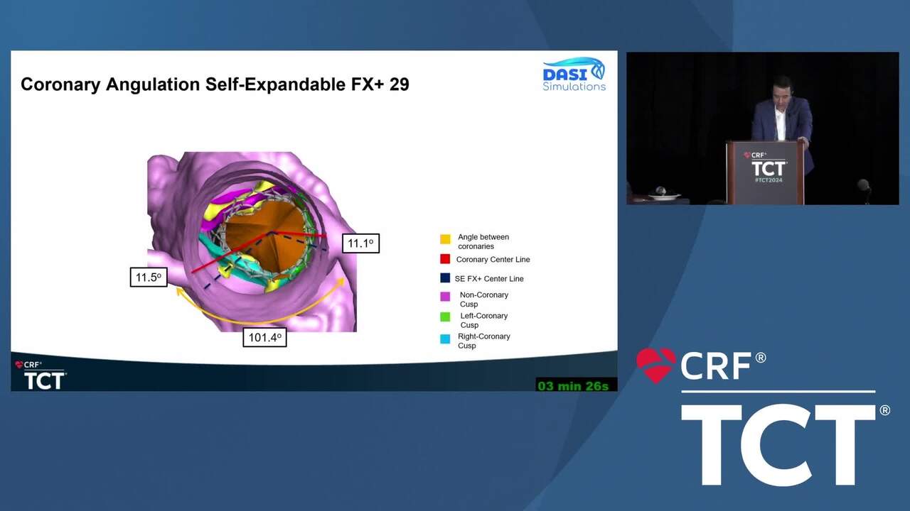 Next Generation TAVR Planning with DASI Simulations: Artificial Intelligence and Prediction-Based Algorithms