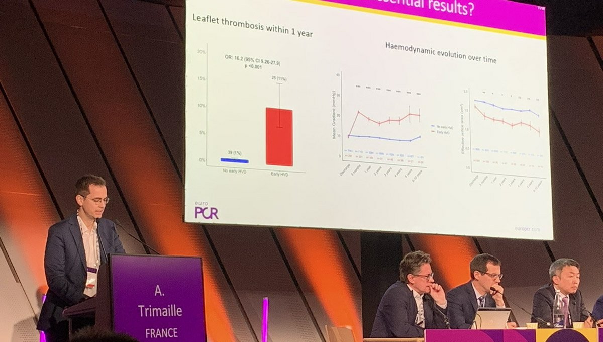 After TAVI, Early Hemodynamic Valve Deterioration May Elude Detection