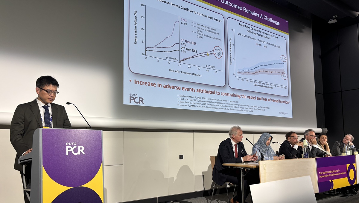 Unlocking Coronary Implant Impressive at 4 Years: BIOADAPTOR RCT