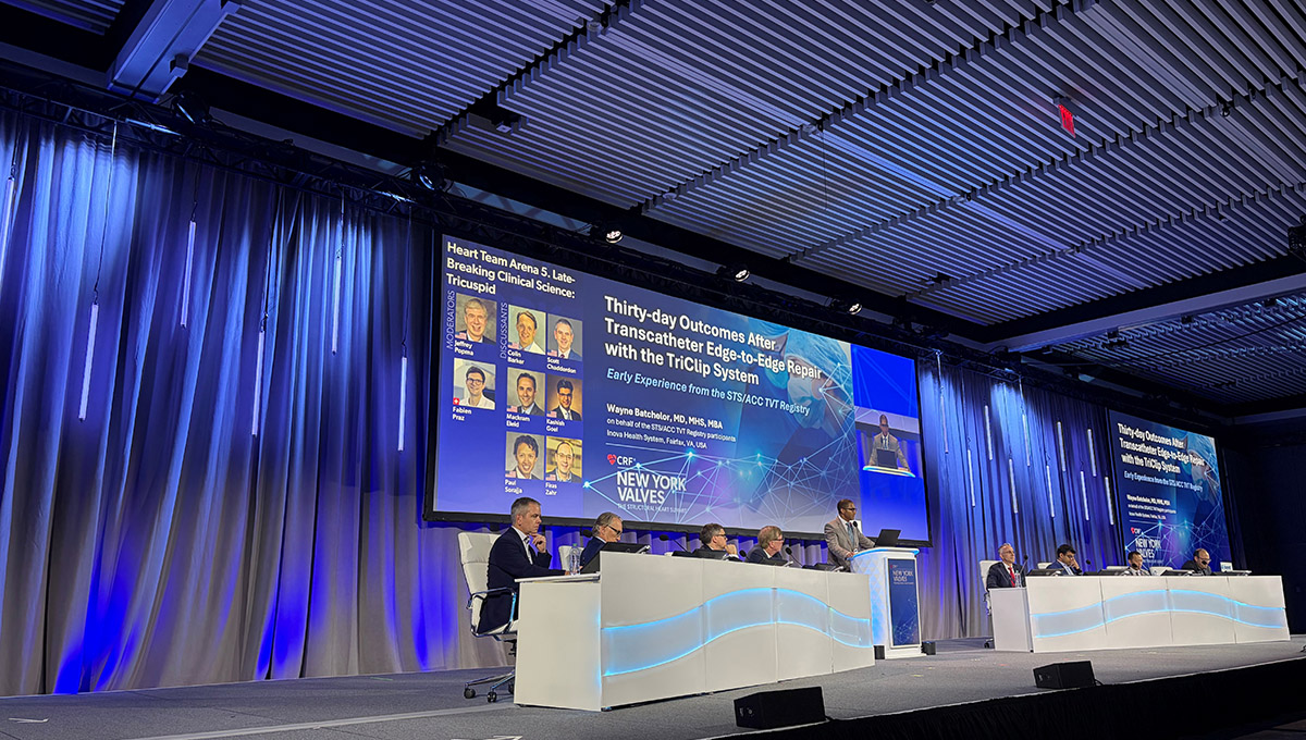 Real-world TriClip Data Show Reduced TR, Good Procedural Success