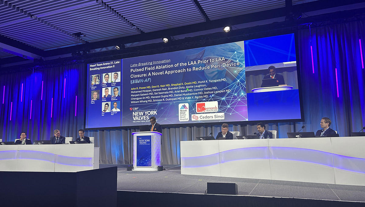 STUN-AF: Ablation Before LAAO May Reduce Peridevice Leaks