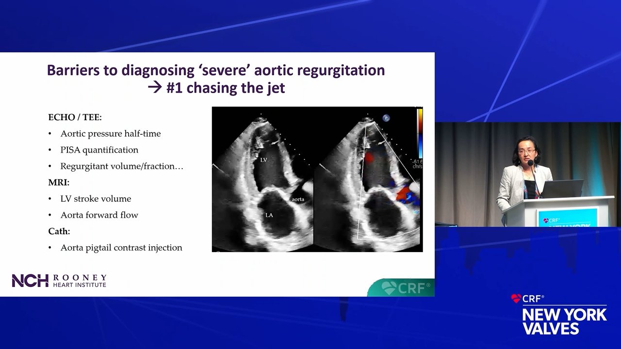 Rethinking Aortic Regurgitation in 2026: Gaps, Guidelines, and Innovation