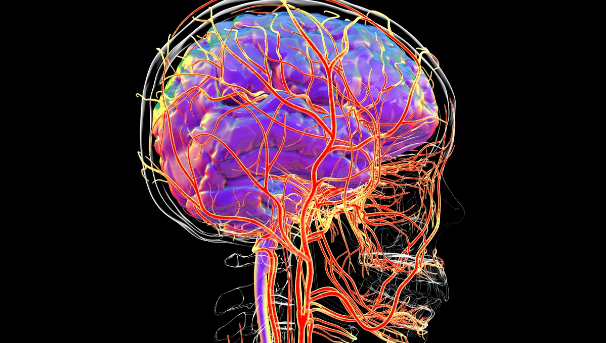 Intraoperative Hypotension Tied to Worse Outcomes After Stroke Thrombectomy