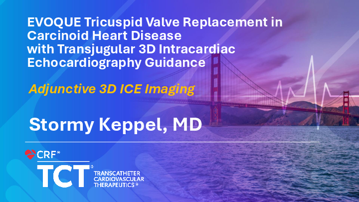 TCT 1529: EVOQUE Tricuspid Valve Replacement in Carcinoid Heart