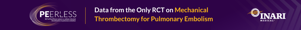 The Clinical PE Story: PEERLESS RCT Comparing FlowTriever to CDT