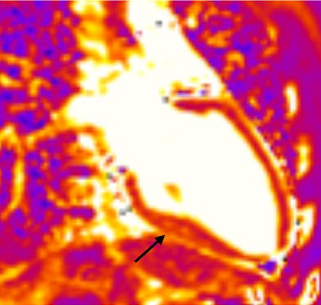 MRI image