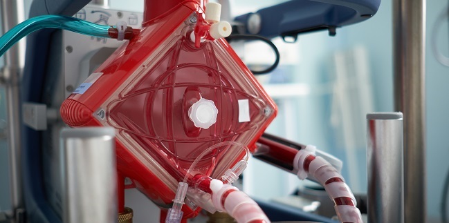 Mechanical Circulatory Support in COVID-19 Mixed Results, Hints of Hope