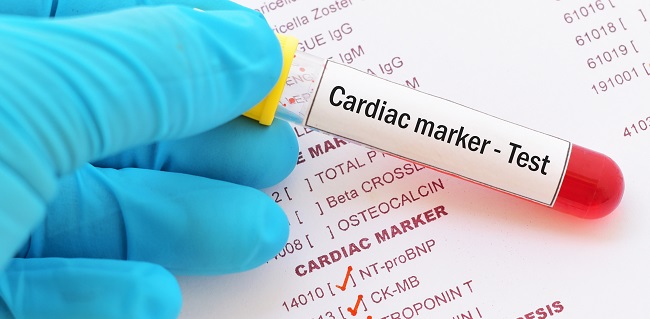 Myocardial Injury Seen in Over One-Third of Hospitalized COVID-19 Patient