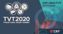 TVT2020