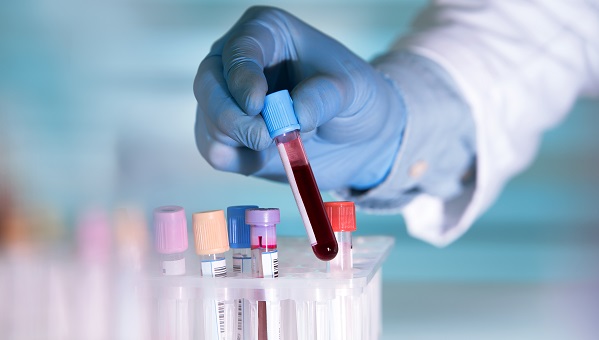 VTE Risk Higher After Oxford AstraZeneca COVID-19 Vaccine, Study Affirms