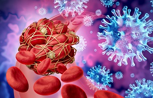 blood clot