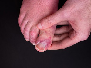 holding toes