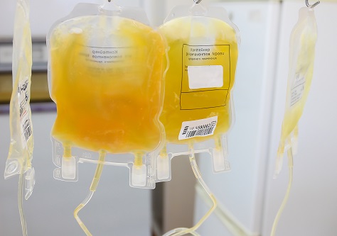 Plasma