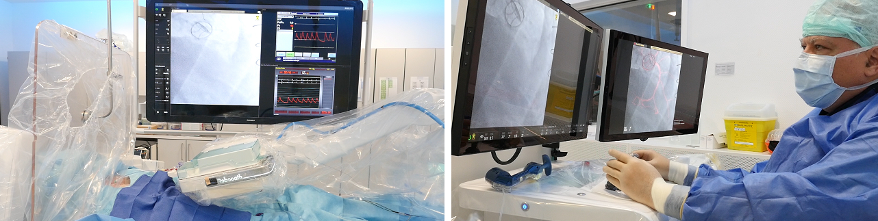 Robocath successfully completes first robotic coronary angioplasties in Germany with R-One™