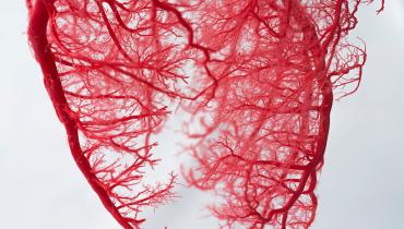 Dig Deeper When Dealing With Nonobstructive CAD, AHA Urges