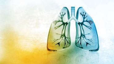 PRAGUE-26: Catheter-Directed Thrombolysis Beneficial in Intermediate-High-Risk PE