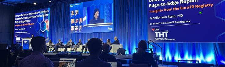 NT-proBNP Provides Info on Who Will Fare Well After Tricuspid TEER