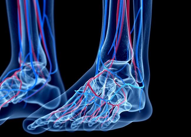 Low Ankle-Brachial Index a Harbinger of Poor Physical QoL and Lack of Mental Vitality