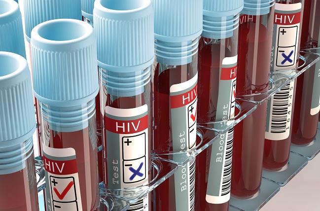 HIV-Positive Patients Face Elevated Rate of Type 2 MI