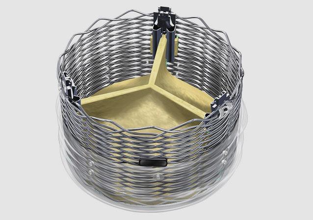 Lotus TAVR Device with Depth Guard Reduces Risk of Pacemaker Implantation