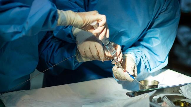 FDA Warns Against Off-Label Use of Balloon Angioplasty to Treat Autonomic Dysfunction