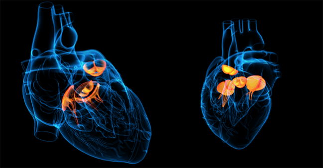 MitraClip for Tricuspid Regurgitation Gains Traction but Still in Preliminary Stages