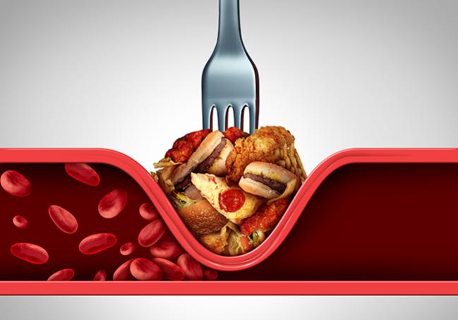Is Atherosclerosis an LDL-Cholesterol or Immune Disease? The Answer May Be Both