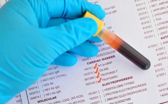 CV Risk Higher With Modestly Elevated Troponin Levels, but Clinical Relevance Remains Unclear