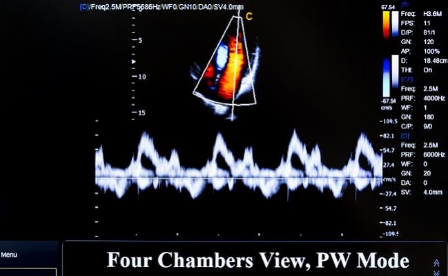 Improving Echo Appropriateness: Audit and Feedback Intervention Works