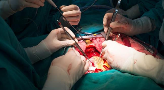 Multiarterial CABG Gets a Boost in Retrospective Analysis 