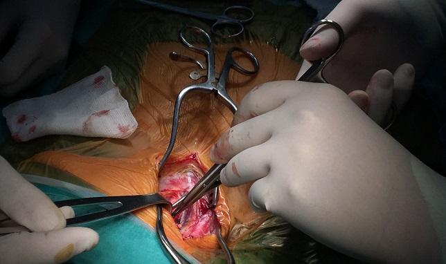 Asymptomatic Carotid Artery Stenosis: When to Screen and When to Intervene