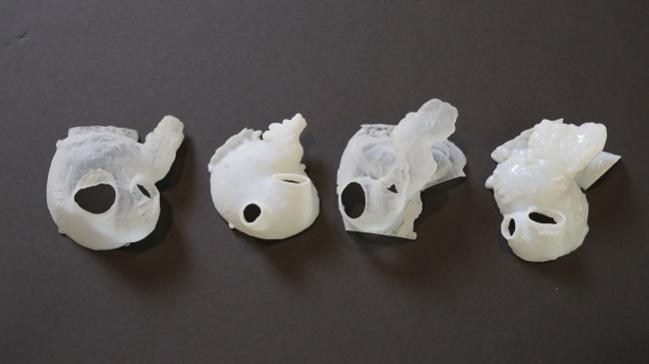 3-D Printing Opportunities Emerge for Cardiologists, Hospitals, and Device Companies Alike