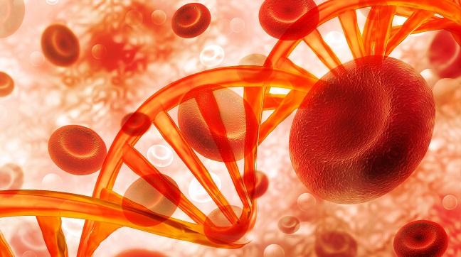 Genetic Study Hints at Role of Lipids in AAA Risk