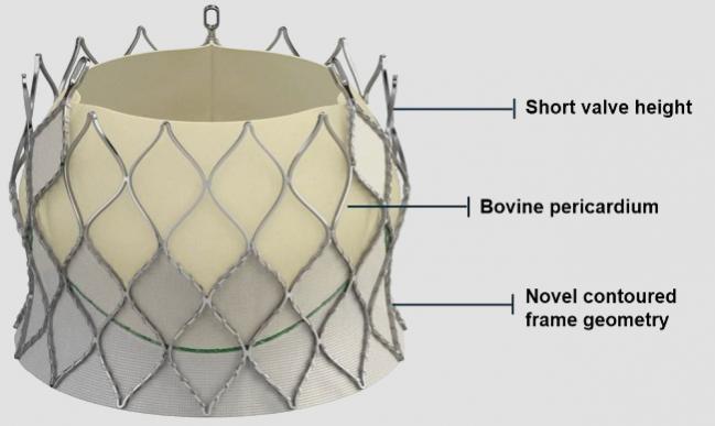 Novel Repositionable TAVR Device Sees Low Pacemaker Rates and Few Leaks