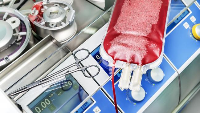 New Guideline Aims to Standardize Anticoagulation During Cardiopulmonary Bypass