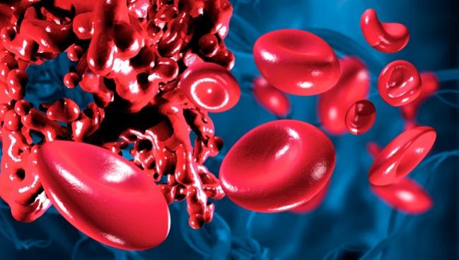 Meta-analysis Supports Benefits of Short-term DAPT Among Elderly Patients