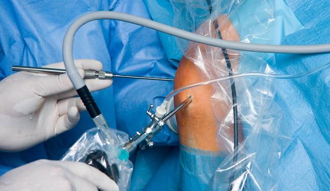 Aspirin Switch for VTE Prevention After Hip/Knee Arthroplasty: Safe, Effective, and Cost-Saving in EPCAT II