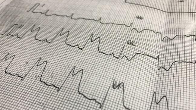 Multivessel PCI Improves Outcomes in STEMI Patients With Cardiogenic Shock: Korean Registry