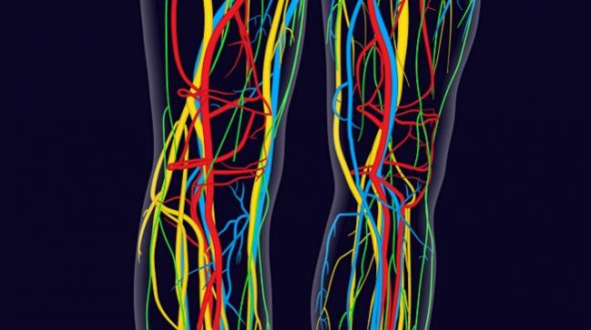 Noninvasive Testing of CLI: Many Ways to Draw Up a ‘Roadmap’